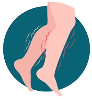 Les Jambes Agitées et Douloureuses