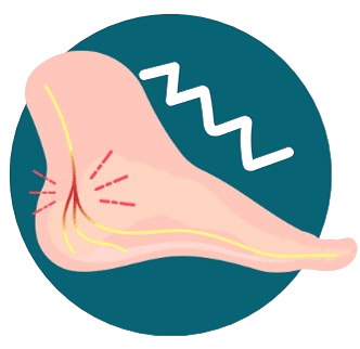 Les Douleurs Nerveuses Fulgurantes